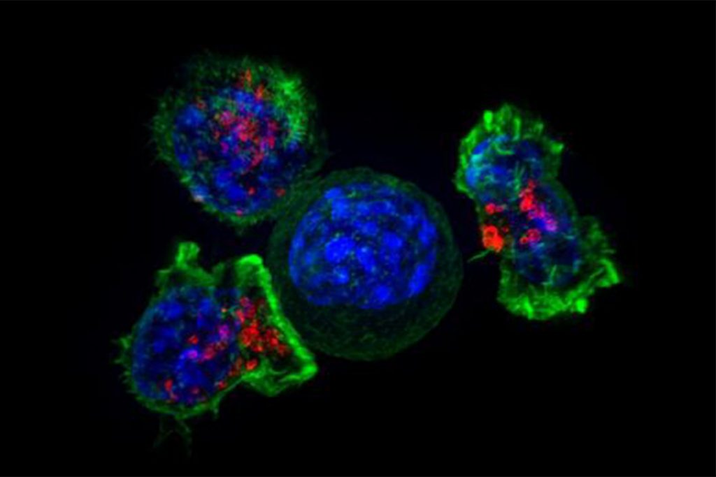 A cancer cell is surrounded by immune T killer cells (photo courtesy of National Institutes of Health)