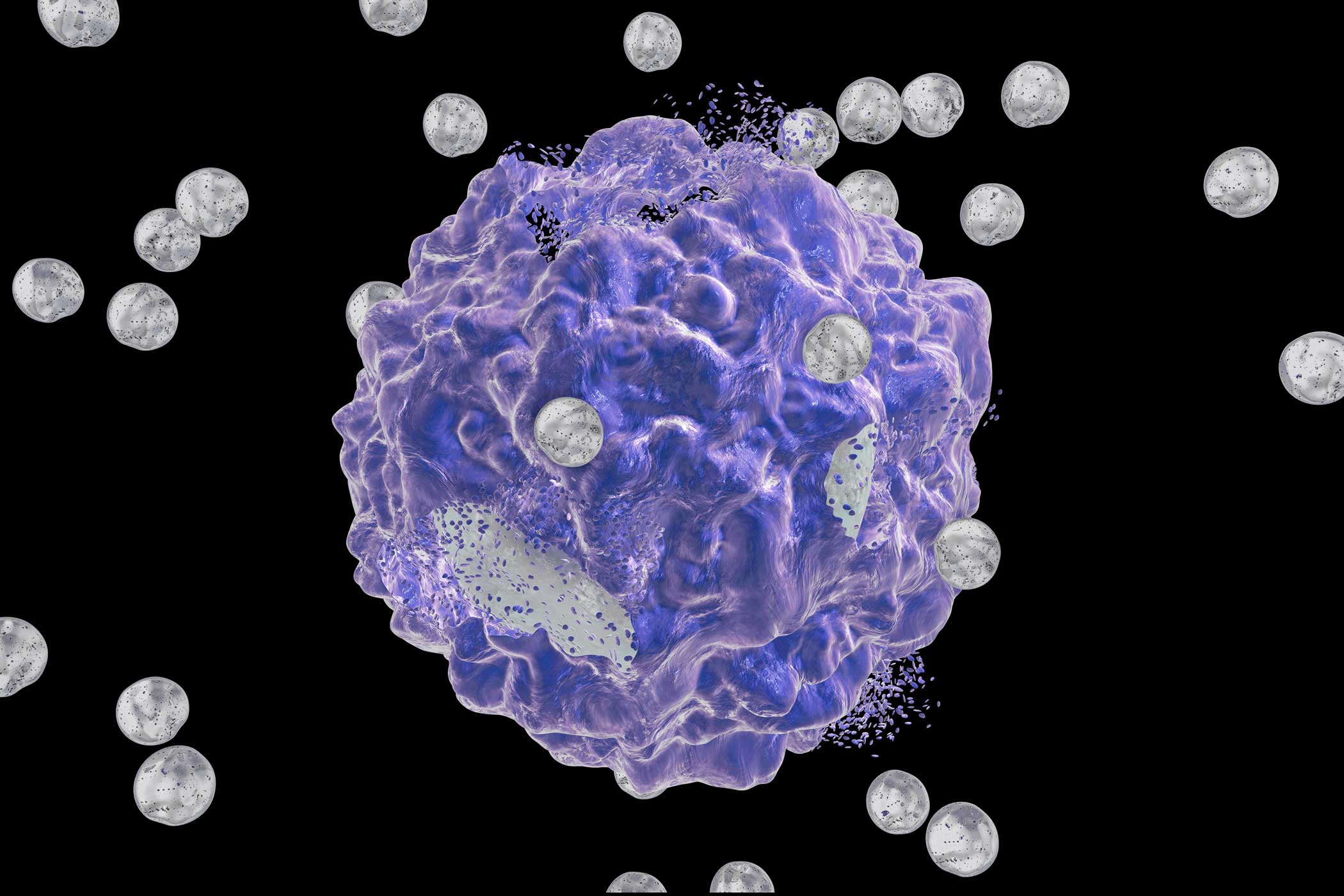 A round mauve-coloured cancer cell being attacked by smaller, silver-coloured nanoparticles.