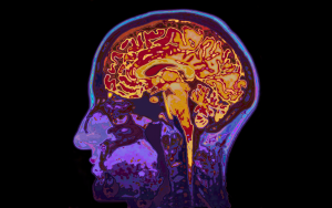 A brain scan of a person in profile showing the brain and brain stem inside the skull.