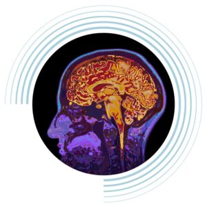 A brain scan of a person in profile showing the brain and brain stem inside the skull.